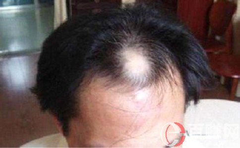 分享一個(gè)剛需性很強(qiáng)的賺錢項(xiàng)目,你聽說(shuō)過(guò)嗎? 第2張